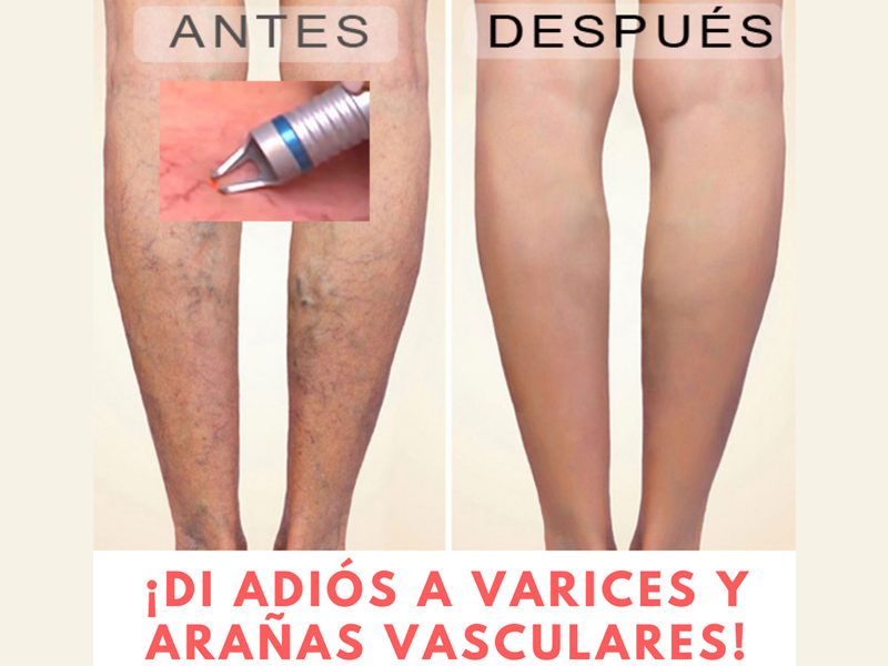 Negocio-rentable-estetica
