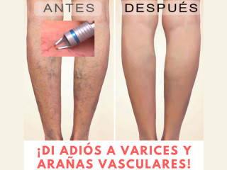 Negocio-rentable-estetica